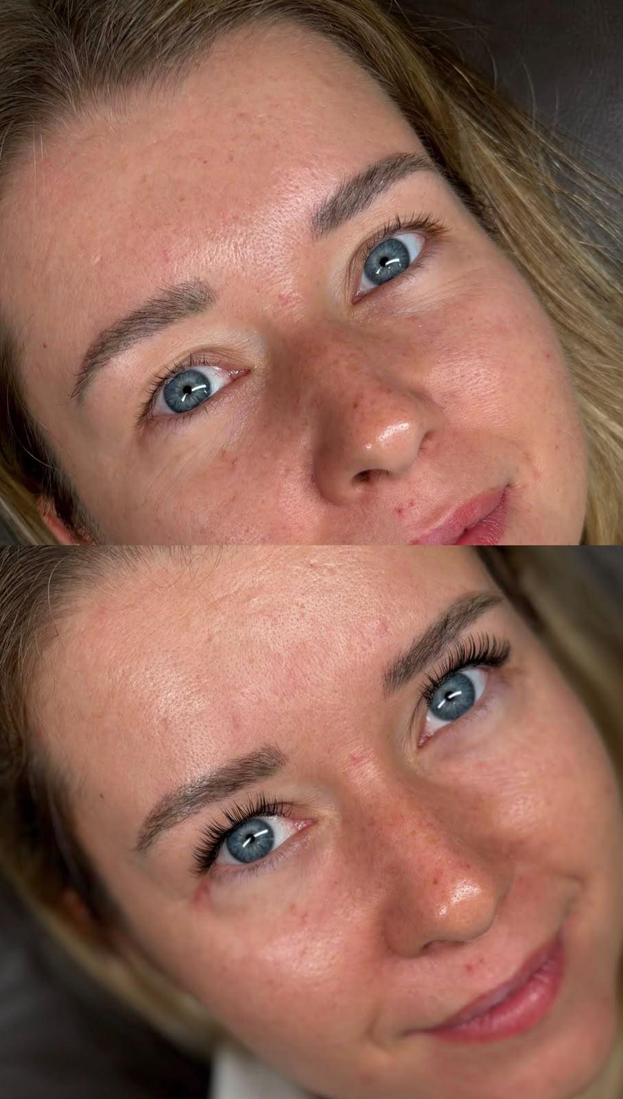 Before Natural Classic eyelash extensions
